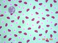 Ladybugs Green Fabric